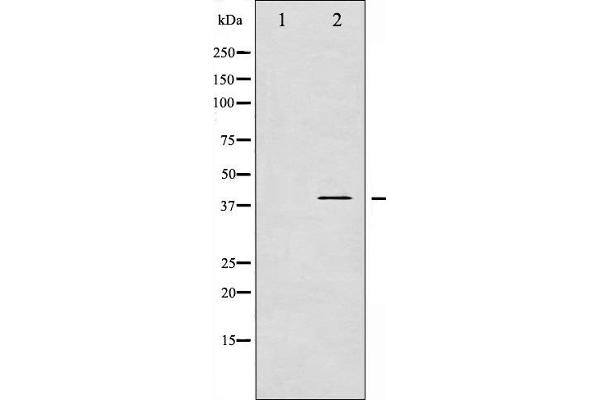 anti-Adrenergic, beta-2-, Receptor, Surface (ADRB2) (pSer346) antibody
