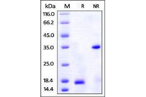 Image no. 2 for Platelet-Derived Growth Factor beta Polypeptide (PDGFB) (AA 82-190) (Active) protein (His tag,AVI tag) (ABIN2870687)