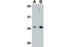 Image no. 2 for anti-three Prime Repair Exonuclease 1 (TREX1) (Internal Region) antibody (ABIN6657041)