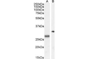 Image no. 5 for anti-Proopiomelanocortin (POMC) (C-Term) antibody (ABIN185387)