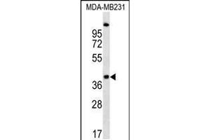 Image no. 2 for anti-RCD1 Required For Cell Differentiation1 Homolog (RQCD1) (AA 106-134) antibody (ABIN5538563)