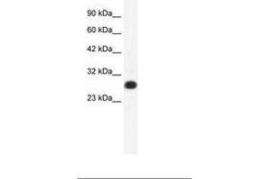 Image no. 1 for anti-General Transcription Factor IIF, Polypeptide 2, 30kDa (GTF2F2) (AA 132-181) antibody (ABIN202121)