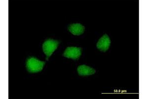 Immunofluorescence of purified MaxPab antibody to KLF8 on HeLa cell.