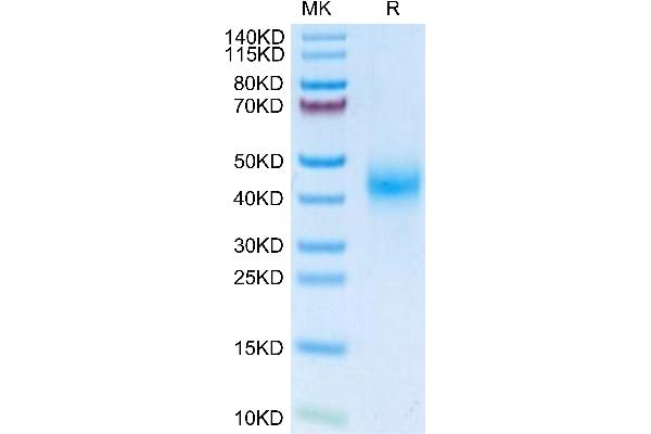 Fc gamma RII (CD32) protein (His tag)