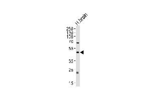 ABHD12 anticorps  (N-Term)