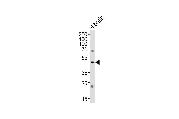 ABHD12 Antikörper  (N-Term)