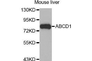 Image no. 1 for anti-ATP-Binding Cassette, Sub-Family D (Ald), Member 1 (ABCD1) antibody (ABIN1870725)
