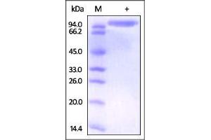 Image no. 1 for Dipeptidyl-Peptidase 4 (DPP4) (AA 29-766) protein (ABIN2180980)