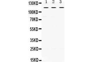 Image no. 1 for anti-Unc-5 Homolog C (C. Elegans) (Unc5c) (AA 894-930), (C-Term) antibody (ABIN3042323)
