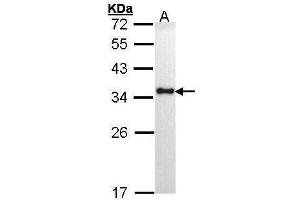 Image no. 1 for anti-HLA Class II DR alpha (HLA-DRA) (Center) antibody (ABIN2855205)