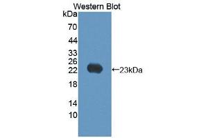 Image no. 2 for anti-Keratin 17 (KRT17) antibody (ABIN3201630)