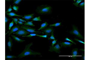 Image no. 7 for anti-N-Myc (And STAT) Interactor (NMI) (AA 1-307) antibody (ABIN522555)