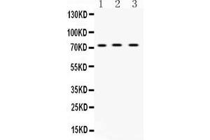 Image no. 1 for anti-ATP-Binding Cassette, Sub-Family G (WHITE), Member 8 (ABCG8) (AA 328-371), (Middle Region) antibody (ABIN5518720)