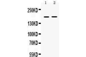 Ceruloplasmin anticorps  (AA 20-258)