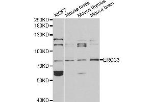 anti-DNA Repair Protein Complementing XP-B Cells (ERCC3) antibody
