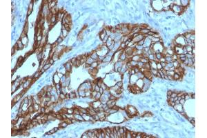 Image no. 4 for anti-Tumor-Associated Calcium Signal Transducer 2 (TACSTD2) (AA 31-274) antibody (ABIN6939972)