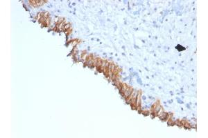 MAML2 anticorps