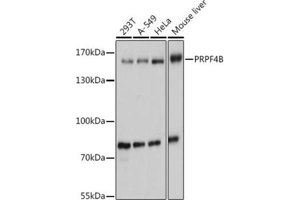 PRPF4B Antikörper  (AA 550-760)