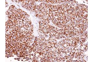IHC-P Image Immunohistochemical analysis of paraffin-embedded AGS xenograft, using ALDH2, antibody at 1:100 dilution.