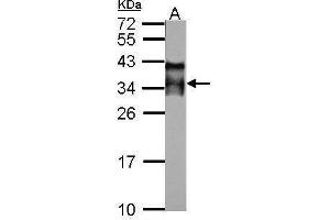 Image no. 1 for anti-Acrosomal Vesicle Protein 1 (ACRV1) (Center) antibody (ABIN2854573)