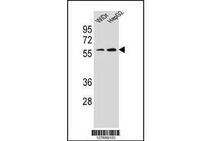 Image no. 2 for anti-Homeobox A10 (HOXA10) (AA 244-271) antibody (ABIN654234)