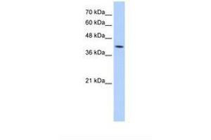 Image no. 1 for anti-Mannose-6-Phosphate Receptor (Cation Dependent) (M6PR) (AA 51-100) antibody (ABIN320797)