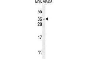 Image no. 2 for anti-Myc Target 1 (MYCT1) (AA 142-171), (C-Term) antibody (ABIN953561)