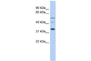 Image no. 1 for anti-T-Complex 11, Testis-Specific (TCP11) antibody (ABIN632031)