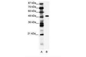 Image no. 1 for anti-Zinc Finger Protein 541 (ZNF541) (AA 783-832) antibody (ABIN203199)