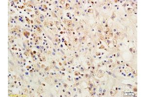 Formalin-fixed and paraffin embedded: rat brain tissue labeled with Anti-SOCS 1 Polyclonal Antibody , Unconjugated 1:200 followed by conjugation to the secondary antibody and DAB staining