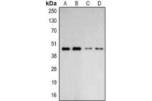 Image no. 2 for anti-Actin Related Protein 2/3 Complex, Subunit 1B, 41kDa (ARPC1B) (full length) antibody (ABIN6005228)
