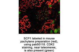 Image no. 1 for anti-Synaptonemal Complex Protein 1 (SYCP1) (C-Term) antibody (ABIN363427)