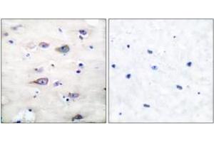 Image no. 2 for anti-Glutamate Receptor, Ionotropic, AMPA 2 (GRIA2) (AA 834-883), (pSer880) antibody (ABIN1531853)
