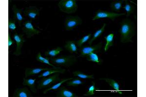 Image no. 4 for anti-Hematological and Neurological Expressed 1-Like (HN1L) (AA 1-190) antibody (ABIN949765)