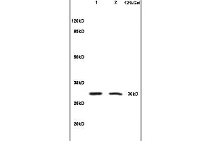 Image no. 5 for anti-Interleukin 1, beta (IL1B) (AA 161-269) antibody (ABIN872644)