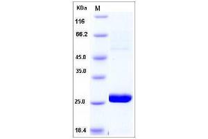 Image no. 1 for Methyltransferase Like 11A (METTL11A) (AA 2-223) protein (ABIN2004121)