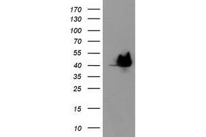 Image no. 2 for anti-HSPA Binding Protein, Cytoplasmic Cochaperone 1 (HSPBP1) antibody (ABIN2723123)