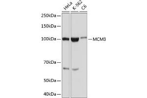 MCM3 anticorps