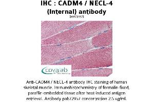 Image no. 1 for anti-Cell Adhesion Molecule 4 (CADM4) (Internal Region) antibody (ABIN1732541)