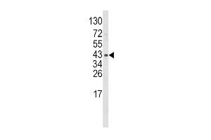 WNT5B antibody  (AA 153-182)