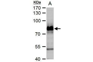 Image no. 5 for anti-Small Nuclear Ribonucleoprotein Polypeptide E (SNRPE) (Internal Region) antibody (ABIN2854894)
