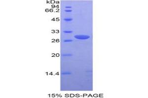 Image no. 1 for Proto-Oncogene Pim-2 (Serine Threonine Kinase) (PIM2) protein (ABIN3011180)