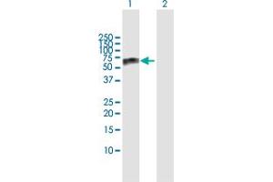 Western Blot analysis of GBA expression in transfected 293T cell line by GBA MaxPab polyclonal antibody.