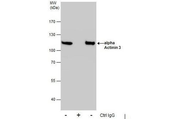 ACTN3 antibody  (Center)