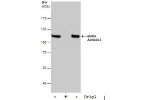 Image no. 4 for anti-Actinin, alpha 3 (ACTN3) (Center) antibody (ABIN2855581)