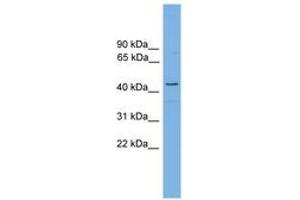 Image no. 1 for anti-Retinol Dehydrogenase 16 (All-Trans) (RDH16) (AA 215-264) antibody (ABIN6744714)