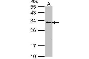 Image no. 3 for anti-Glutathione Transferase zeta 1 (Maleylacetoacetate Isomerase) (GSTZ1) (Center) antibody (ABIN2856258)
