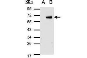 Image no. 2 for anti-Interferon Regulatory Factor 6 (IRF6) (C-Term) antibody (ABIN2855973)
