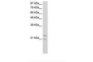 Image no. 3 for anti-Polyamine Modulated Factor 1 (PMF1) (AA 41-90) antibody (ABIN6736317)