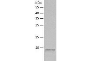 SDF1 beta Protein (AA 22-93) (His tag)